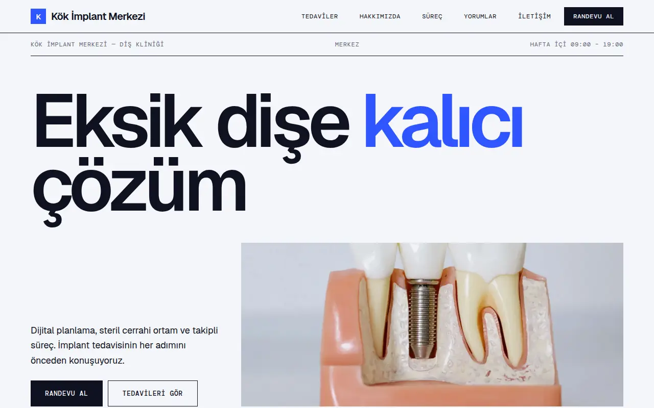 Modern Diş Kliniği Web Sitesi — Kök İmplant Merkezi